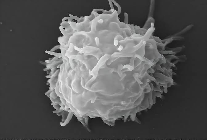 Man dies covered in necrotic lesions after amoebas eat him alive