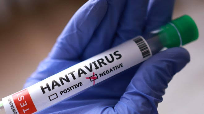 Oregon doctor who helped cruise patients tests positive for hantavirus