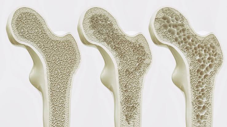 Scientists may have found a way to keep your bones strong for life