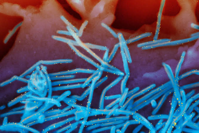 RSV is still spreading, prompting states to extend the immunization period