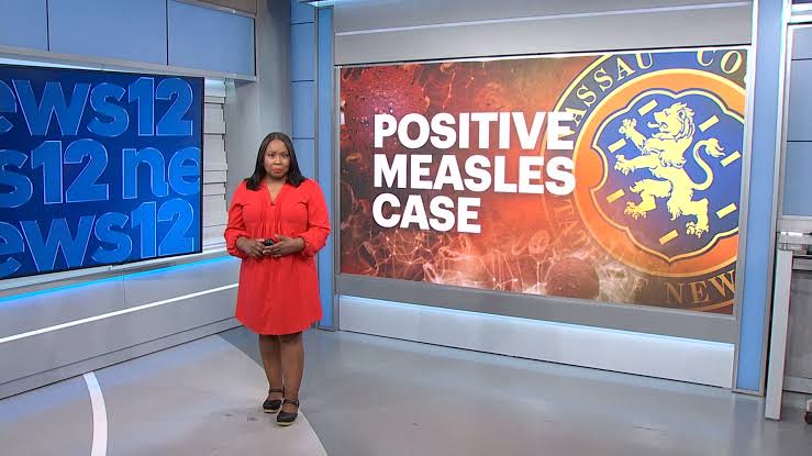 Unvaccinated child tests positive for measles in Nassau County, first positive case since 2024