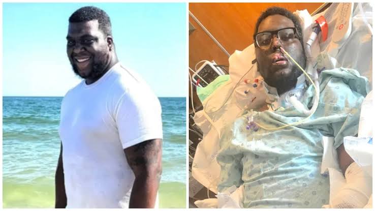 Man Endures Sepsis and Triple Amputation After Routine Dental Exam