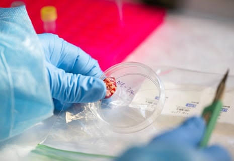 CDC temporarily halts testing for several infectious diseases amid staffing shortages