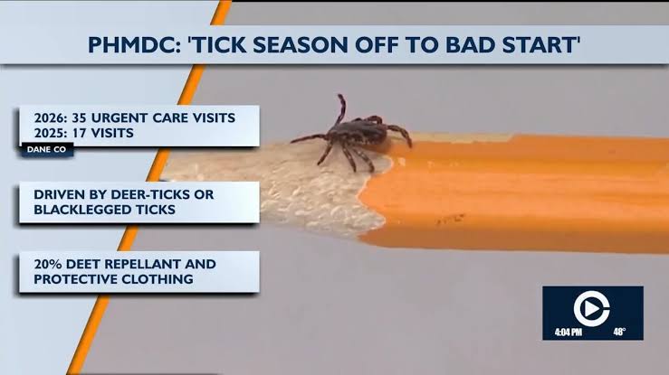 Dane County sees surge in tick-related urgent care visits
