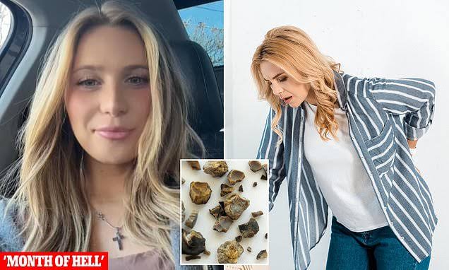 Kidney stone epidemic sweeps America: Try simple fix to avoid agony