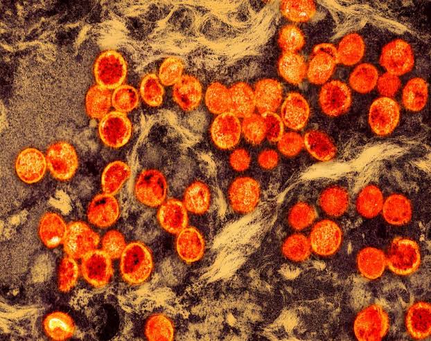 San Francisco Reports Its First Clade I Mpox Case — What to Know and How to Find a Vaccine