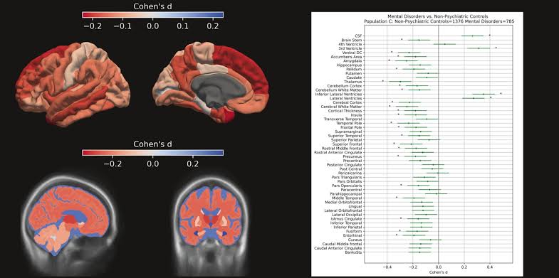 Real-world MRI data confirm shared brain signatures of mental health disorders