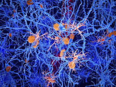Blocking A Single Protein In Alzheimer’s Disease Could Boost The Brain’s Cleanup Crew, Slowing Memory Loss