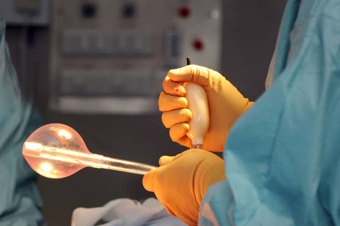 Intragastric Balloon Therapy: A Minimally Invasive Option for MASLD and Obesity Management