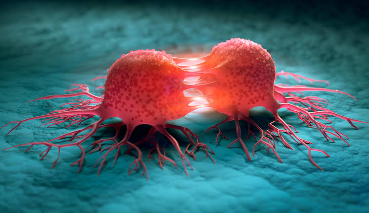 Bowel and Ovarian Cancers Are Dramatically Rising in Young Adults and Scientists Aren’t Sure Why