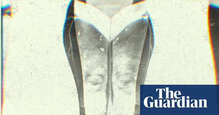 Puffy legs, heavy aches, rippled skin: what is lipedema?