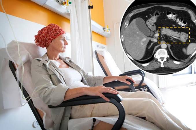 New tool can find deadliest cancer years before tumors can be seen on a scan