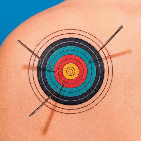 What Is Dry Needling? And Does It Work?