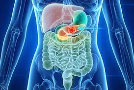 Multiorgan Radiomic Analysis Has Potential to Predict Pancreatic Cancer