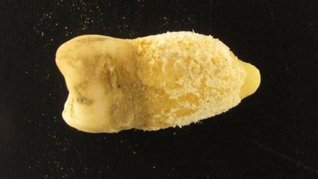 A Bolivian Mummy's Tooth Is Rewriting The History of Scarlet Fever