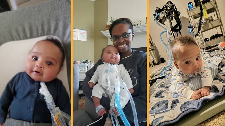 'Two lives hang in the balance': Risky surgery in the womb saved baby from deadly disorder at just 25 weeks gestation