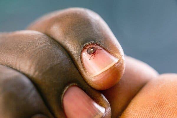 Tick Season: What to Know About Bites and Symptoms