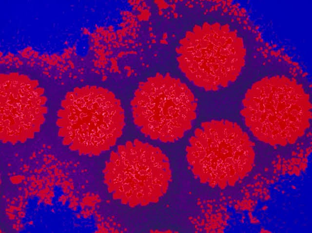 Stomach bug virus resurging in New Jersey, Northeast U.S.