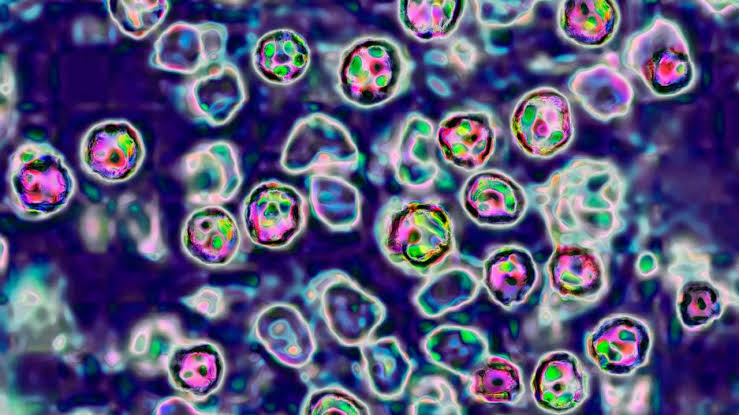DC warns of measles exposure across Metro, Dulles Airport