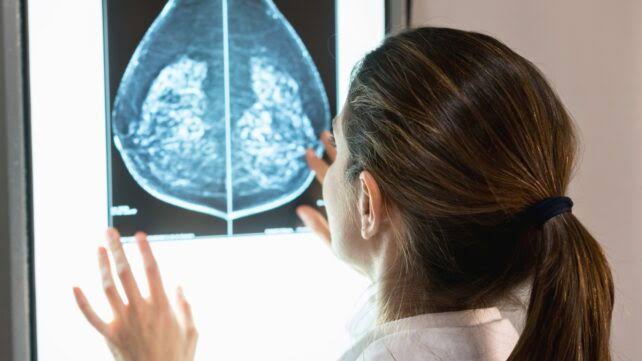 Scientists Reveal Why Breast Cancer Risk Rises With Age