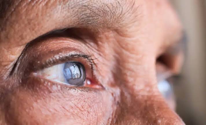 Eye Supplementation: What Is It? And Why More Specialists Are Recommending It