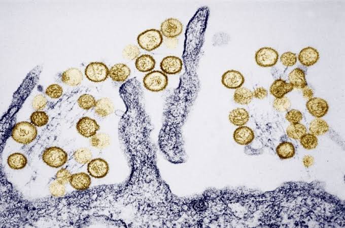 MN resident possibly exposed to Hantavirus