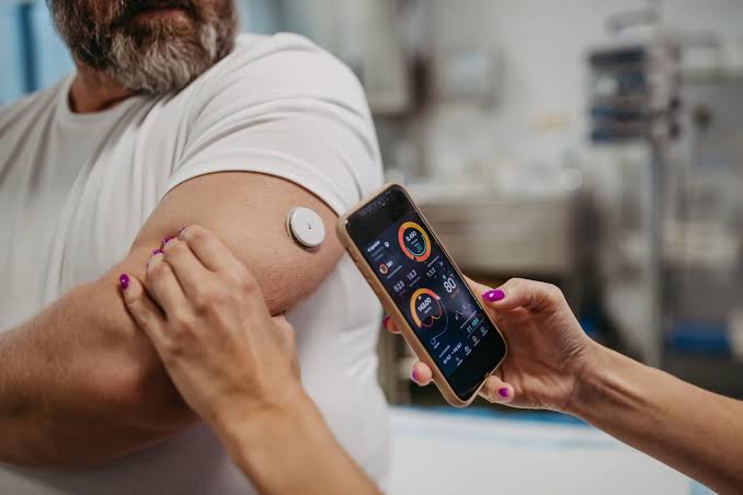 Guest column | I study wearable health data. Here’s what continuous glucose monitors miss.