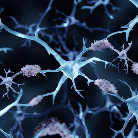 Cochrane review reignites Alzheimer’s amyloid wars