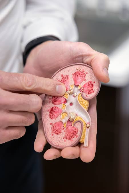 Does drinking water prevent kidney stones? Here’s what experts say.