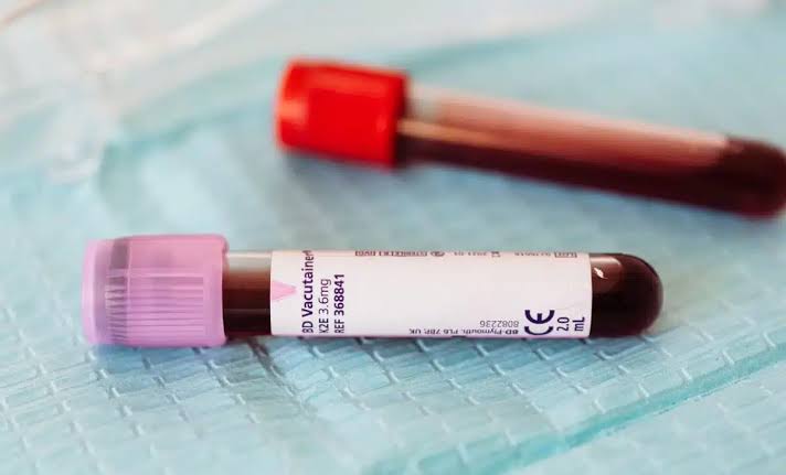 The World’s Rarest Blood Type Just Got Even Stranger, Only 3 People on Earth Have It