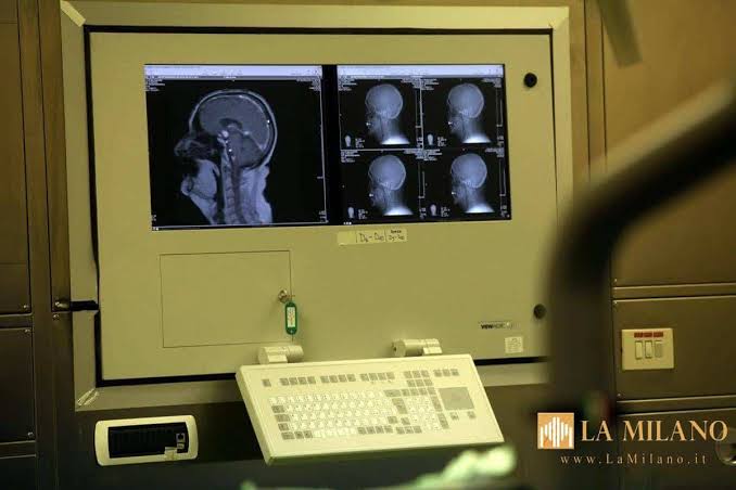 Are restless dreams a symptom of Parkinson's? Doctors are fighting the myth that "it can happen, polysomnography is recommended."