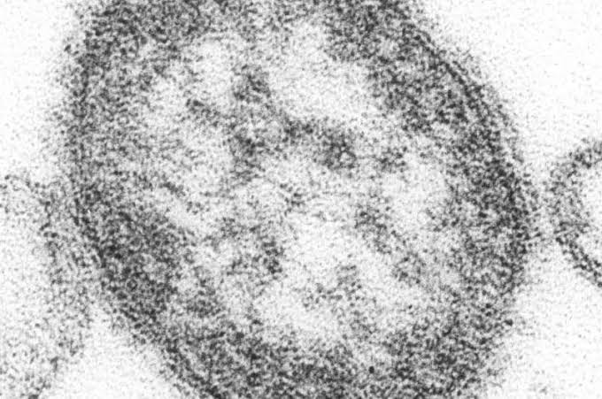 US may lose measles elimination status after outbreaks spread to 45 states