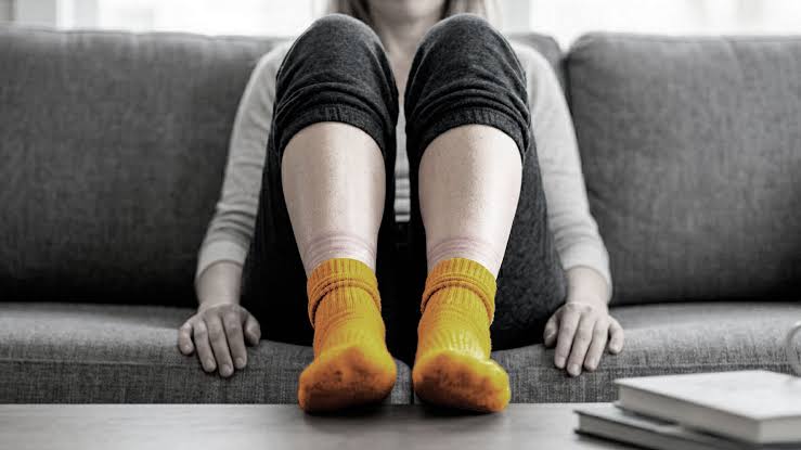 Here's What It Means If Your Socks Leave Marks On Your Legs — And When To Be Concerned