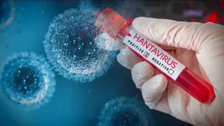 Minnesotan being monitored for potential exposure to hantavirus