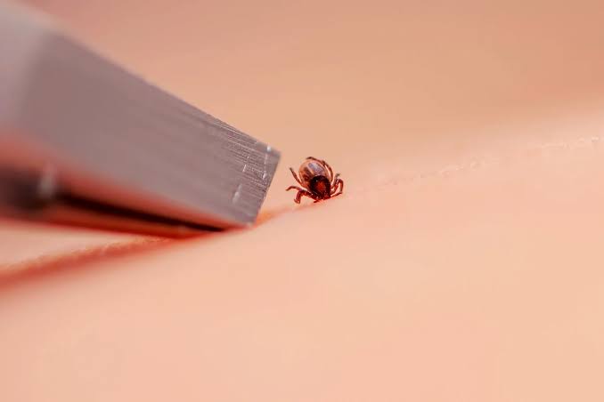 So, you got bit by a tick. Here’s exactly what to do next.