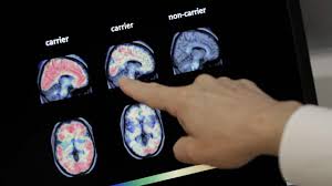 It's probably already in your fridge — and it could help in cutting risk of Alzheimer's