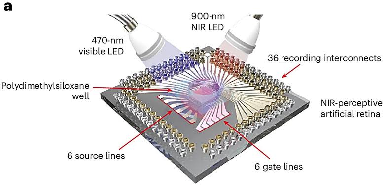This artificial retina doesn't just aim to restore sight—it opens a hidden channel of vision
