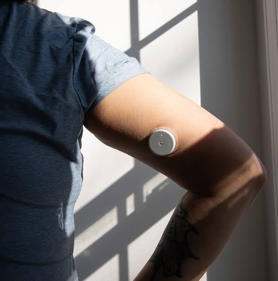 A year of continuous glucose monitoring pushed me to the edge