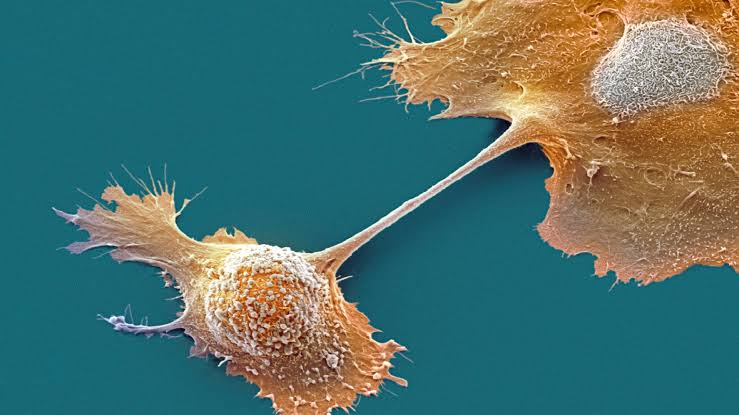 Experimental drug doubles one-year survival in pancreatic cancer