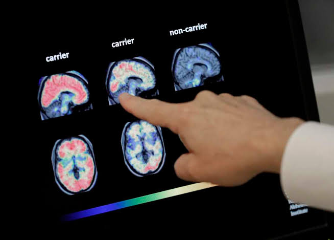Can Chinese AI solve inequality? + How dementia comes for your bank account