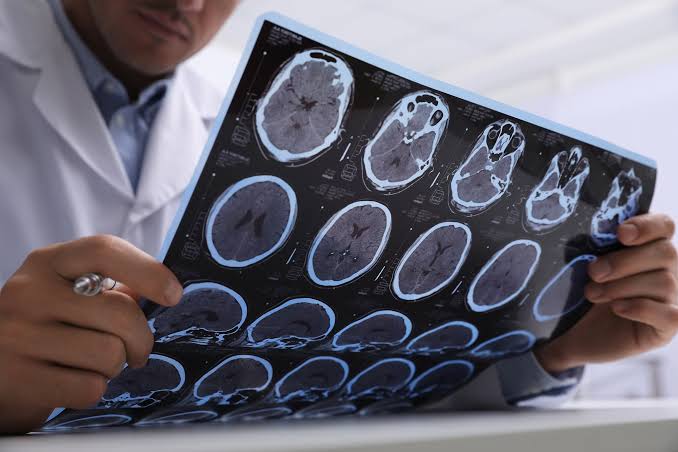New MRI Breakthrough Captures Stunningly Clear Images of the Eye and Brain
