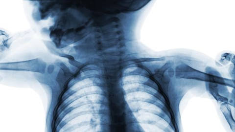 Why Are Human Babies Born With More Bones Than Adults? Hint: Evolution Left Us Unfinished On Purpose