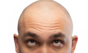 Half of All Men Lose Their Hair but Scientists Just Found a Natural Sugar That May Grow It Back at the Source