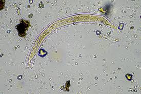 24,000-year-old frozen ‘zombie worm’ thawed by scientists — then it shockingly started reproducing