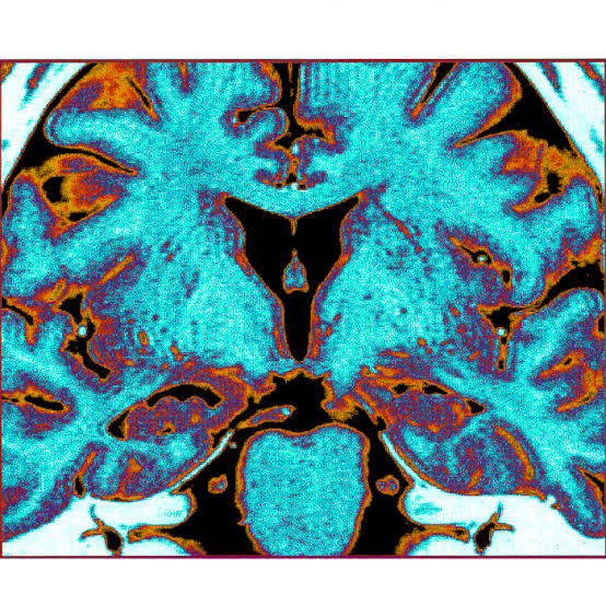 Scientists Successfully Unfroze Part of a Mouse Brain—and It Still Worked