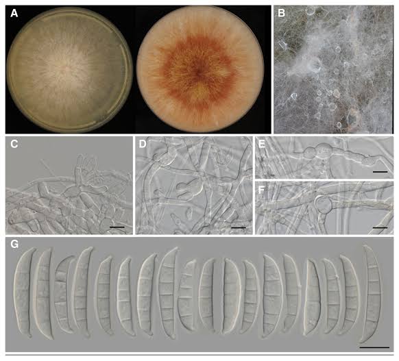 Scientists identify new Fusarium species behind wheat disease outbreak in Ethiopia