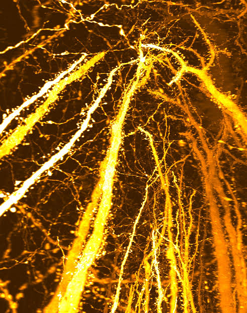 New Brain Discovery Challenges Long-Held Theory of Teenage Brain Development